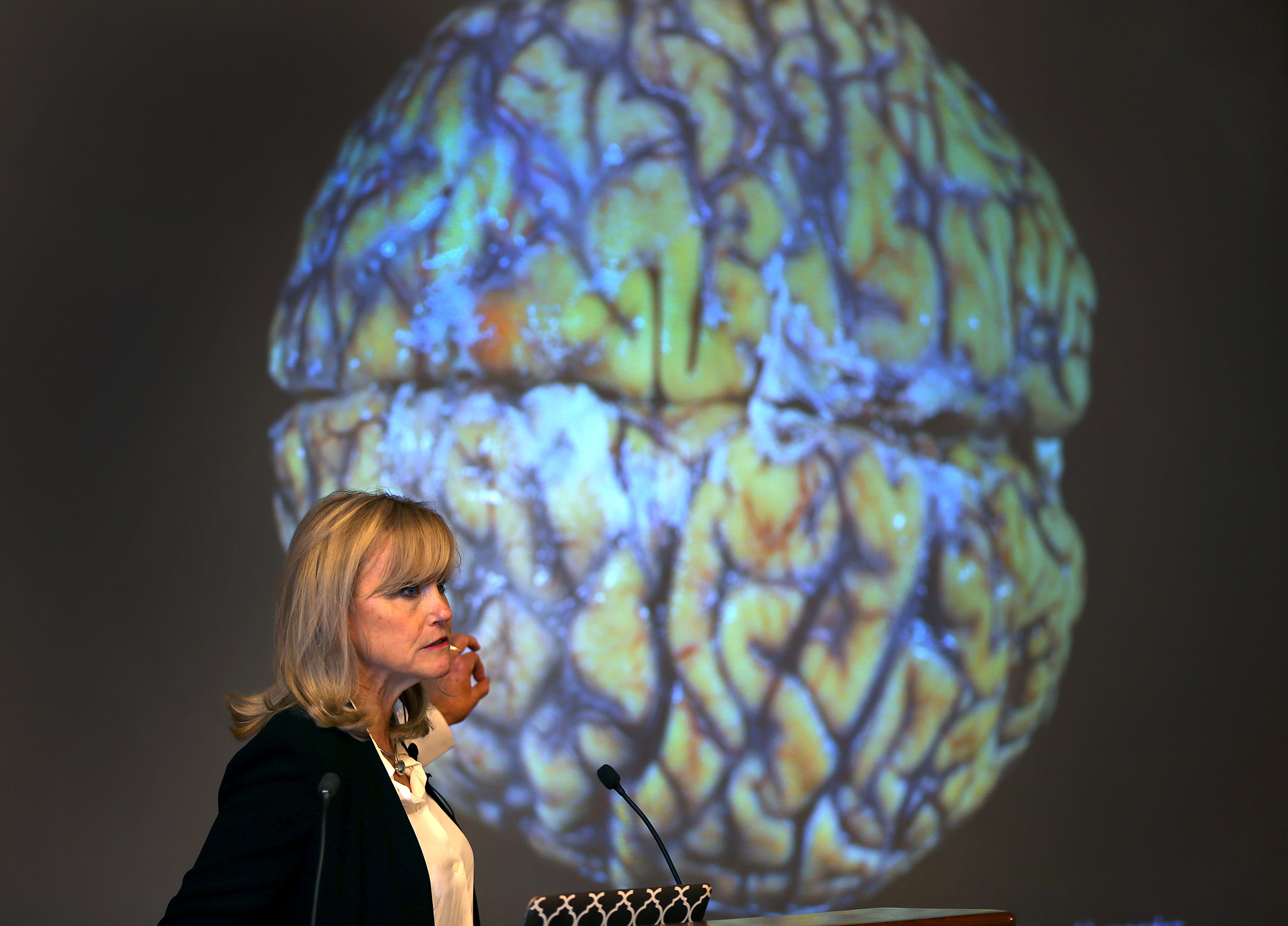 CTE discovered in 40% of athletes who died before age 30